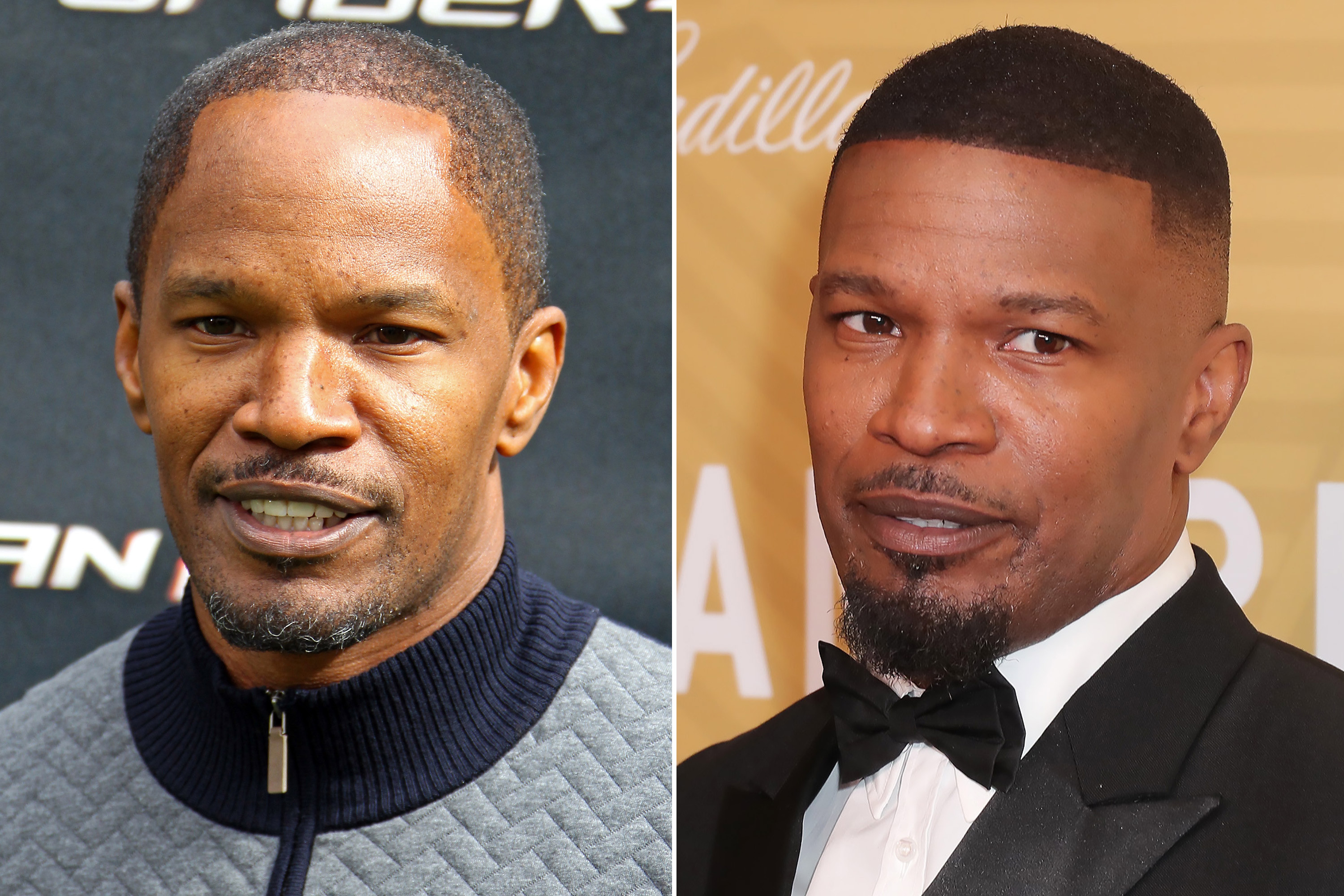 Jamie Foxx’s hairline got a lot lower from 2013 to now. 