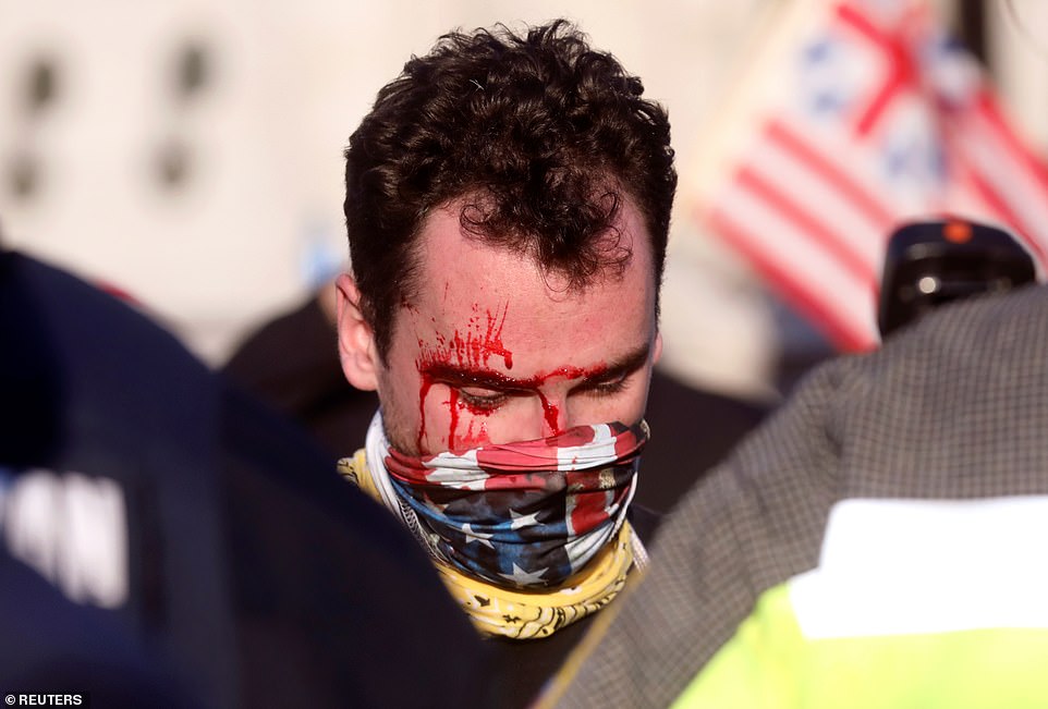 The Trump supporter was bleeding from his head after being beaten in front of Union Station on Saturday
