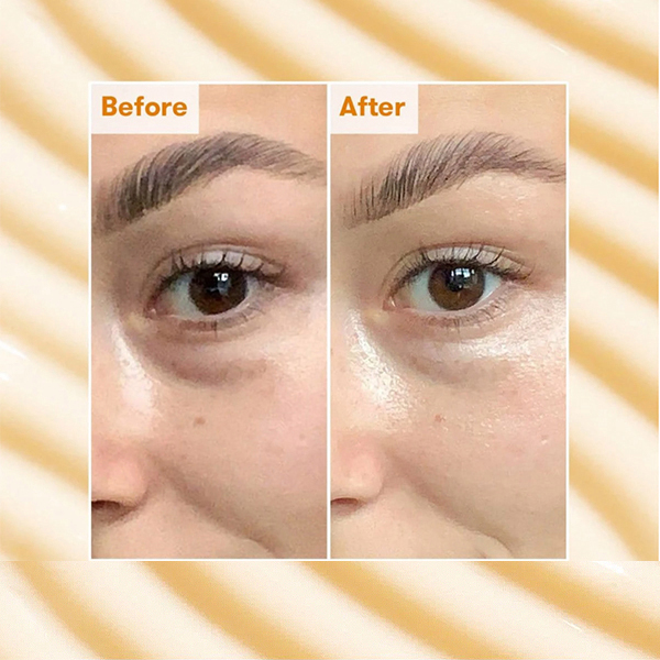 Radiance Brightening Dark Circle Eye Cream