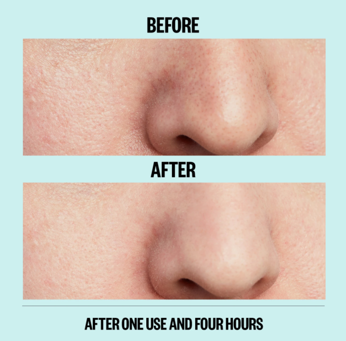 Peace Out Pores Pore Strips