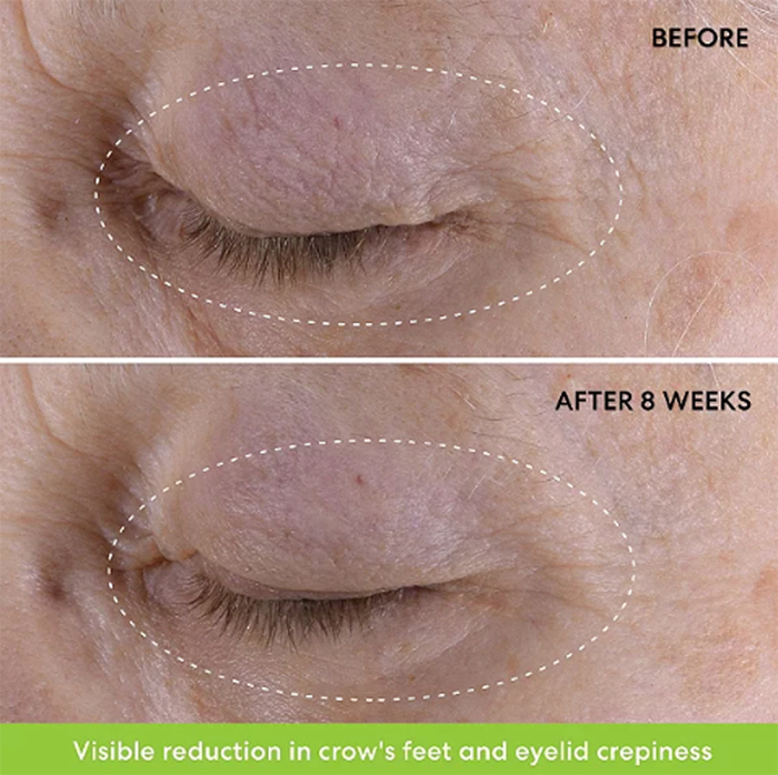 bareminerals-eye-cream-before-after