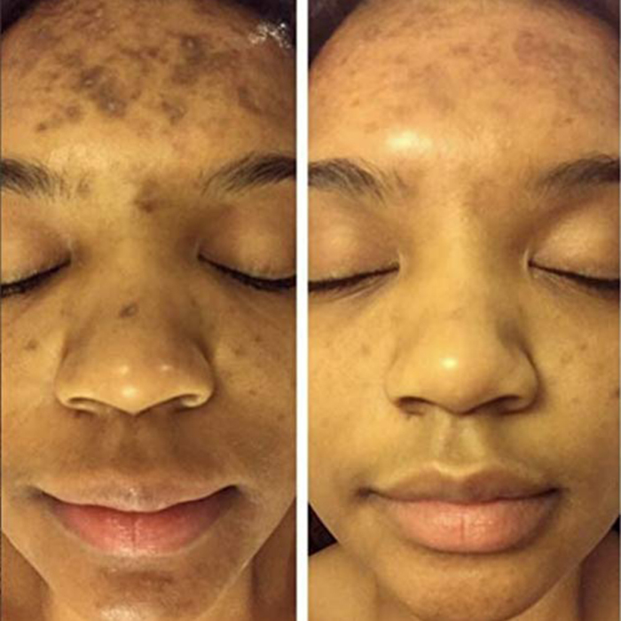 before and after 2