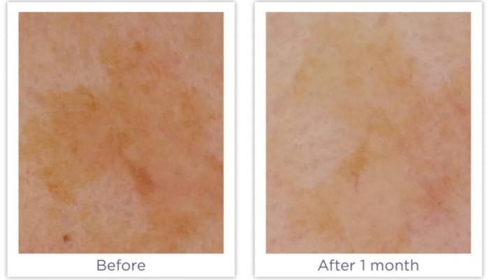 Enhance Brightening Serum