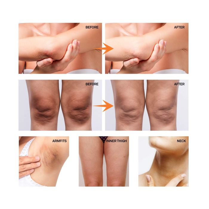 AsaVea Dark Spot Cream Natural Underarm Cream