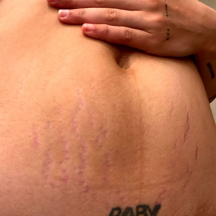 Halsey Shares Candid Snap of Postpartum Body: ‘This Is What It Look Like’