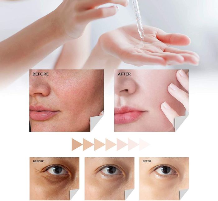 Evagloss Dark Spot Corrector Serum with Kojic Acid