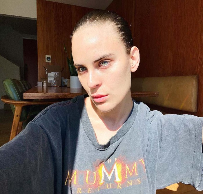 How Talulah Willis Went From Chronic Picker Having Supple Skin