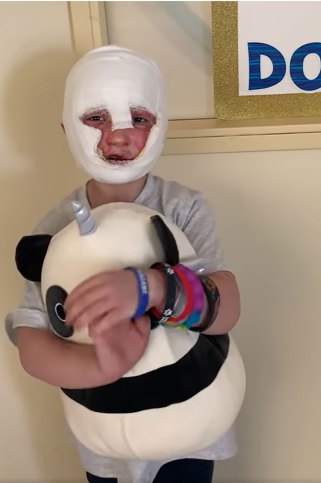 An online fundraiser has raised nearly $600,000 for Dominick Krankall's recovery.