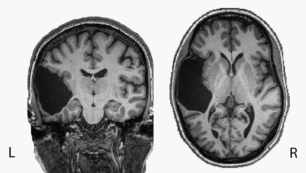 brans scans